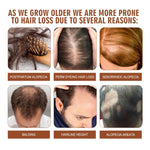 Batana Oil From Honduras - Get Fuller, Thicker, Healthier Hair - Great Gifts For Women  Men Conditioner Haircare Silky - Hair Nutrition FREE delivery Saturday, on orders shipped     4.2 ⭐⭐⭐⭐” 208 ratings brandscluster