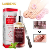 LANBENA Nail Fungus Treatment Anti Fungal 4.2 ⭐⭐⭐⭐⭐” 350 ratings - brandscluster