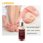LANBENA Nail Fungus Treatment Anti Fungal 4.2 ⭐⭐⭐⭐⭐” 350 ratings - brandscluster