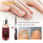 LANBENA Nail Fungus Treatment Anti Fungal 4.2 ⭐⭐⭐⭐⭐” 350 ratings - brandscluster