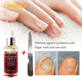 LANBENA Nail Fungus Treatment Anti Fungal 4.2 ⭐⭐⭐⭐⭐” 350 ratings - brandscluster