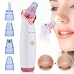 Blackhead Remover Facial Nose Cleaner T Zone Deep Pore ... 4.2 ⭐⭐⭐⭐⭐” 278 ratings - brandscluster