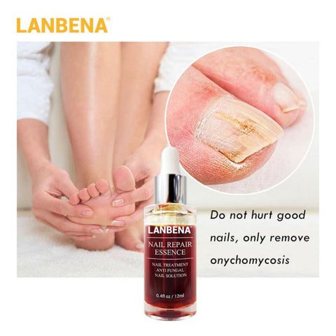 LANBENA Nail Fungus Treatment Anti Fungal 4.2 ⭐⭐⭐⭐⭐” 350 ratings - brandscluster